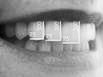 Perfect Smile tooth proportions